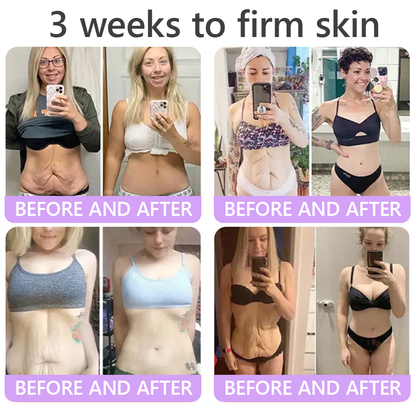 🎁 𝐇𝐈𝐒𝐊𝐈𝐍® Only 5 boxes left! We're offering you an additional 80% discount! Get yourself in shape and healthy. Miss out now, and you won't have another chance until next year.