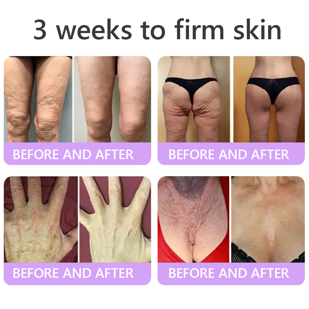 🎁 𝐇𝐈𝐒𝐊𝐈𝐍® Only 5 boxes left! We're offering you an additional 80% discount! Get yourself in shape and healthy. Miss out now, and you won't have another chance until next year.
