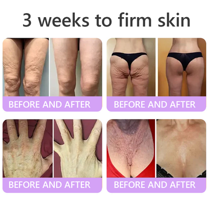 🎁 𝐇𝐈𝐒𝐊𝐈𝐍® Only 5 boxes left! We're offering you an additional 80% discount! Get yourself in shape and healthy. Miss out now, and you won't have another chance until next year.