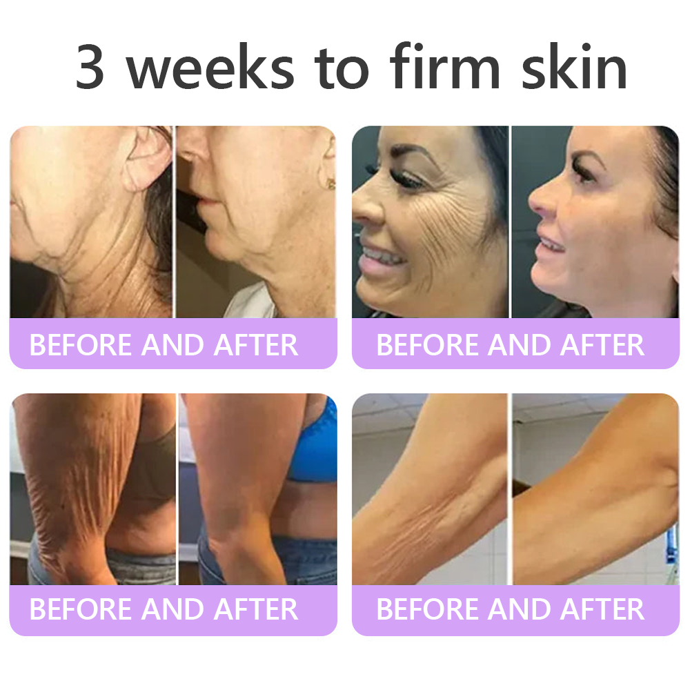🎁 𝐇𝐈𝐒𝐊𝐈𝐍® Only 5 boxes left! We're offering you an additional 80% discount! Get yourself in shape and healthy. Miss out now, and you won't have another chance until next year.
